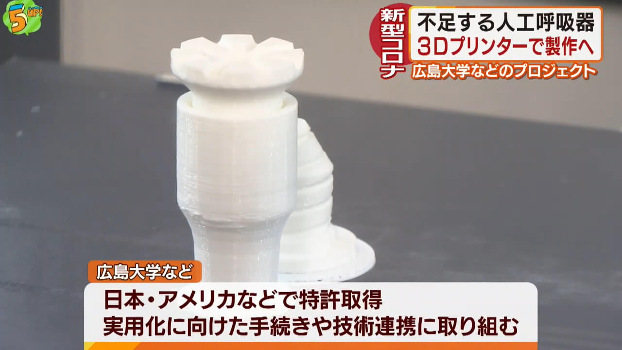 不足する人工呼吸器を３Ｄプリンターで製作　広島大学のプロジェクト始動